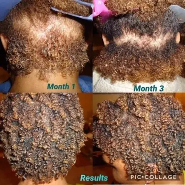 The Bundle that Makes your Hair Grow?