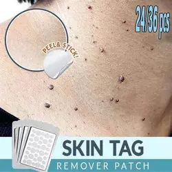 Skin Tag Remover Patch Ance Pimple Patch Plaster Acne Cream