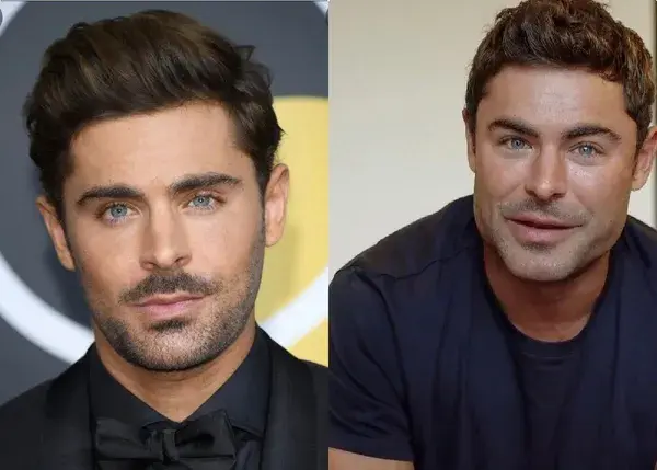 Zac Efron’s new face: Actor explains why he had surgery [watch]