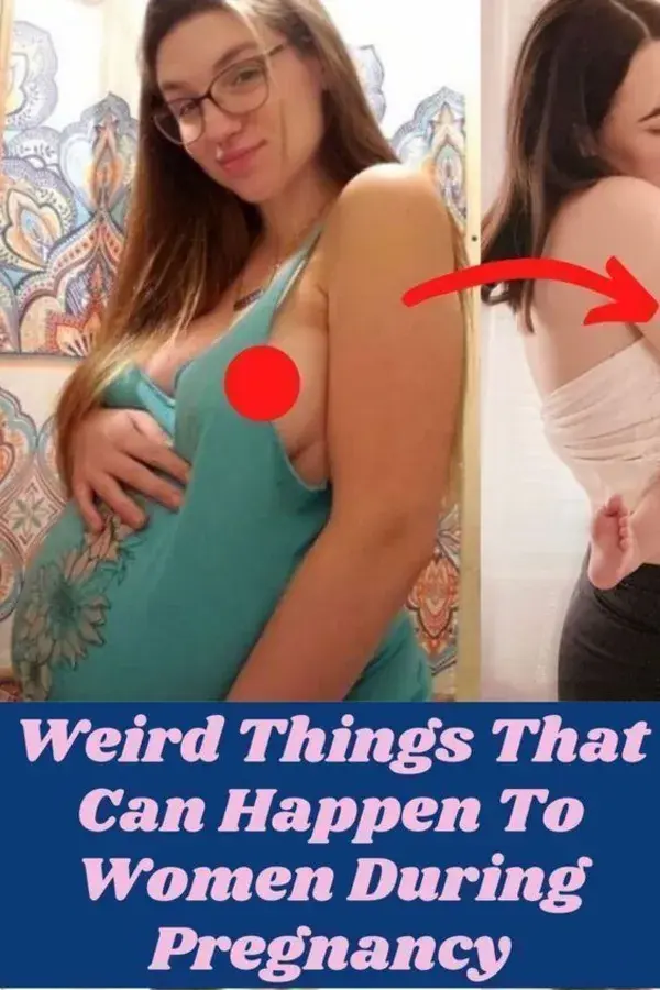 Weird Things That Can Happen To Women During Pregnancy