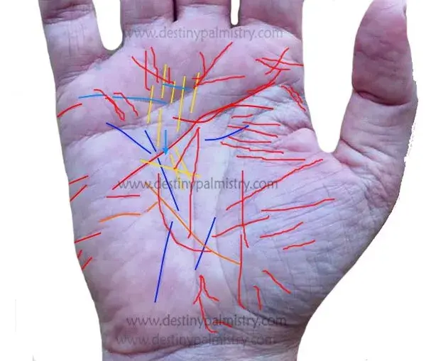 Too Many Palm Lines? What Does it Mean? | Article