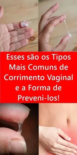 Esses são os Tipos Mais Comuns de Corrimento Vaginal e a Forma de Preveni-los!