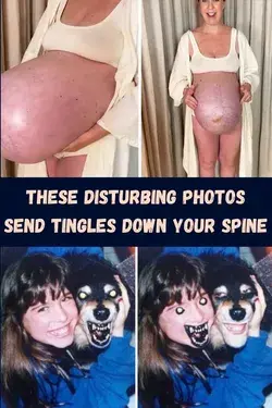 These Disturbing Photos Sent Tingles Down Our Spine