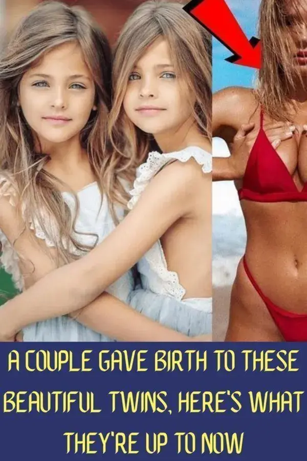 A Couple Gave Birth To These Beautiful Twins, Here's What They're Up To Now