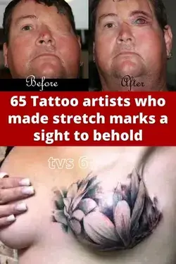 65 Tattoo artists who made stretch marks a sight to behold