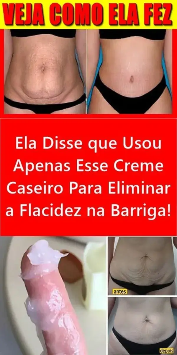 Ela Disse que Usou Apenas Esse Creme Caseiro Para Eliminar a Flacidez na Barriga!