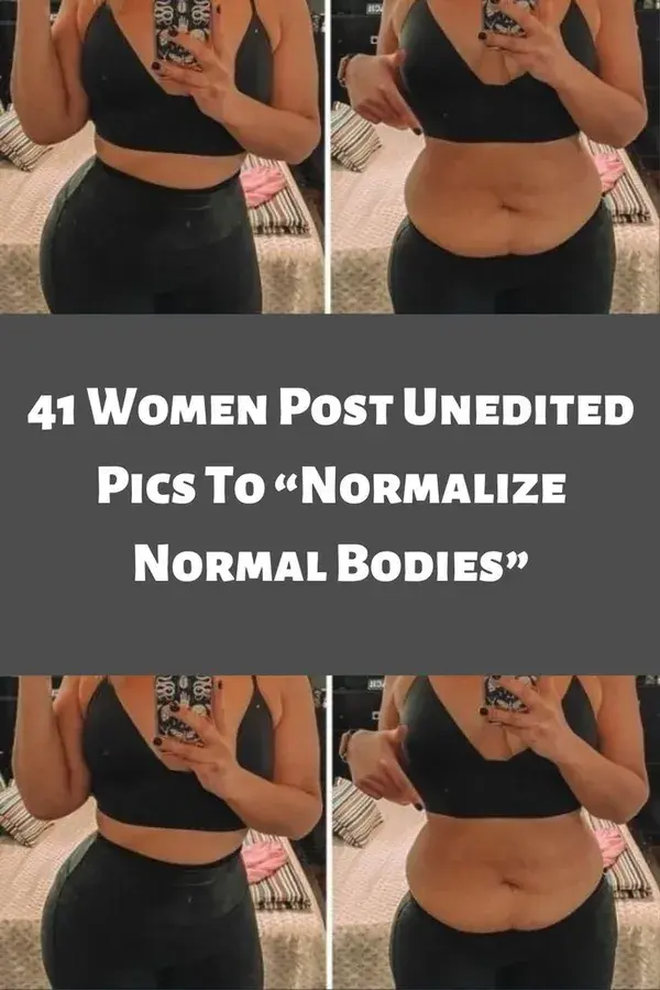 41 Women Post Unedited Pics To “Normalize Normal Bodies”