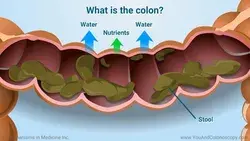 What is a colonoscopy and how do I prepare for it?