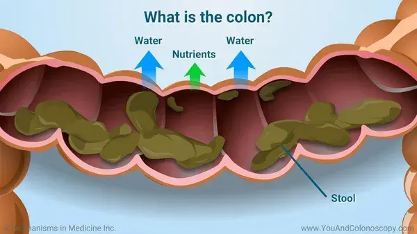 What is a colonoscopy and how do I prepare for it?