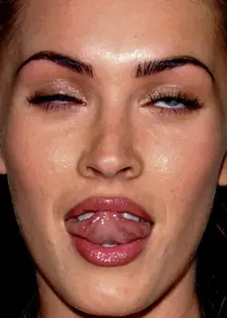 ‘Scary’ truth behind woman’s lip fillers