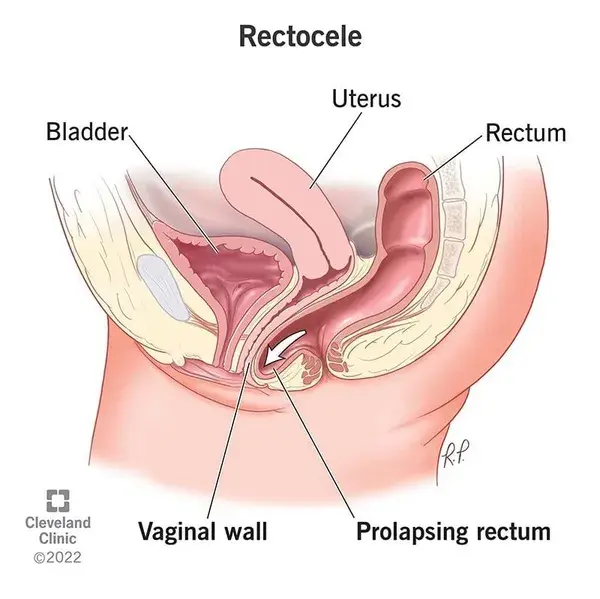 my.clevelandclinic.org