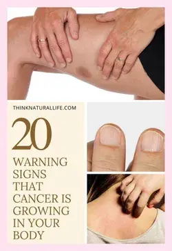 Early Signs That Cancer Is Growing In Your Body