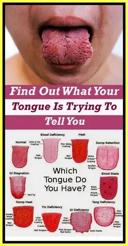 WHAT YOUR TONGUE TELLS ABOUT TOXINS IN YOUR BODY