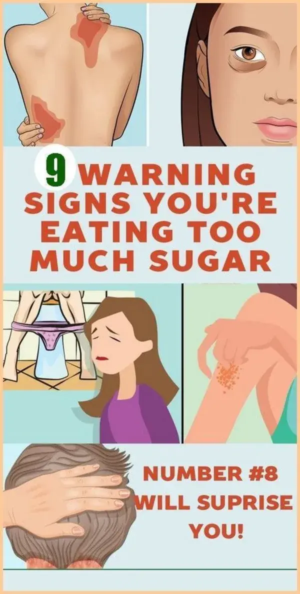 SIGNS YOU�RE EATUNG TOO MUCH SUGAR