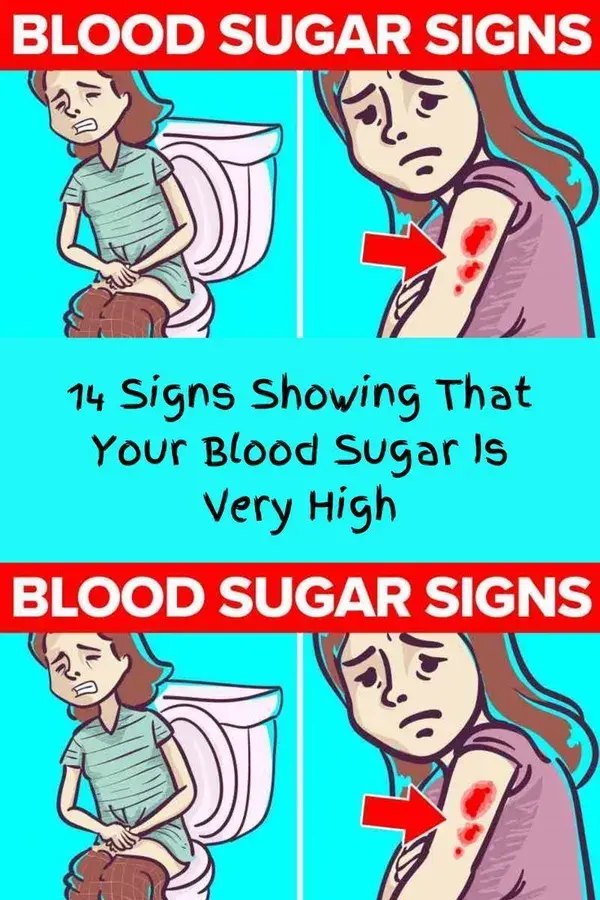 14 Signs Showing That Your Blood Sugar Is Very High