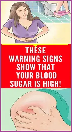 14 Signs Showing That Your Blood Sugar Is Very High