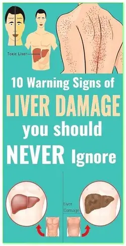 6 Signs That Your Liver Is Full Of Toxins