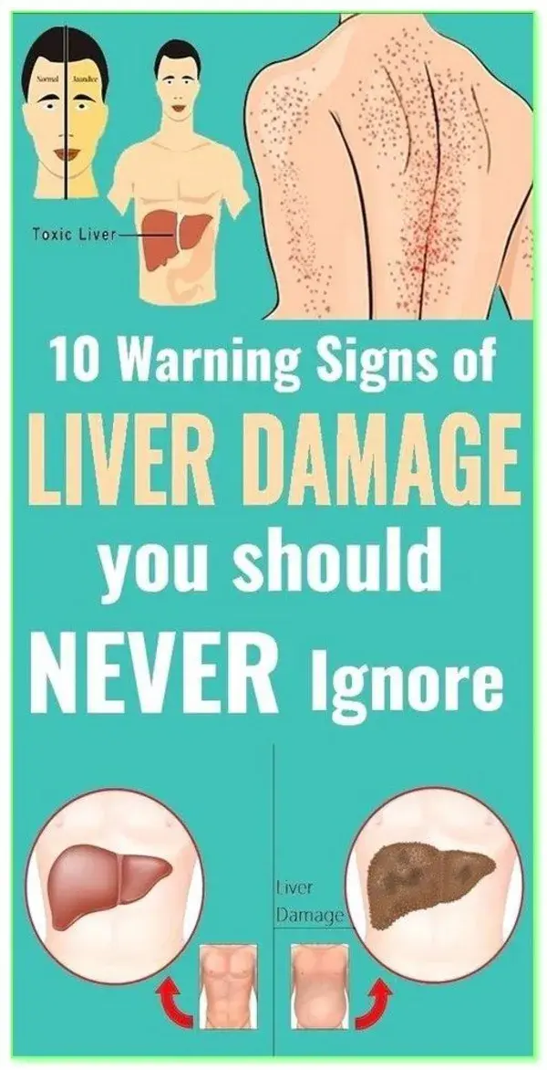 THIS IS AN ALARM FOR A DAMAGED LIVER. DON�T IGNORE!