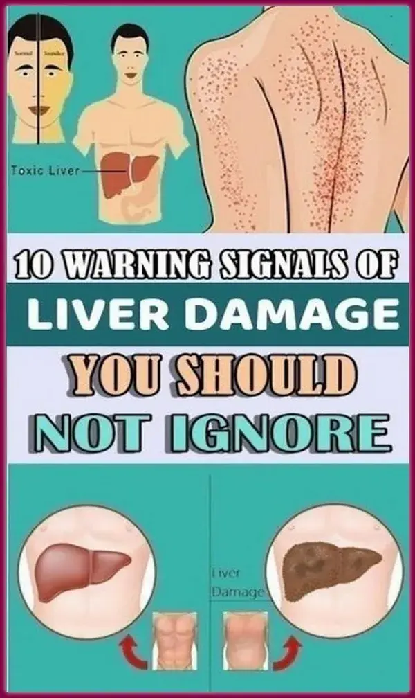 10 Warning Signals of Liver Damage You Should Not Ignore