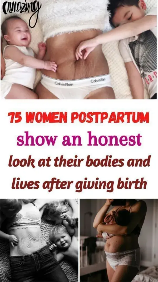 75 Women postpartum show an honest look at their bodies and lives after giving birth