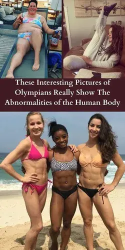These Interesting Pictures of Olympians Really Show The Abnormalities of the Human Body | ScientistP
