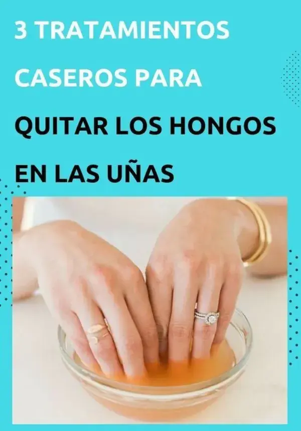 Remedios caseros para acabar con los hongos en las uñas de los pies y manos