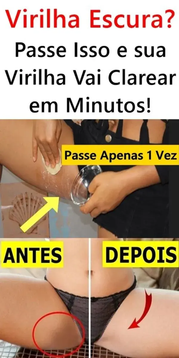 Virilha Escura? Passe Isso e sua Virilha Vai Clarear em Poucos Minutos