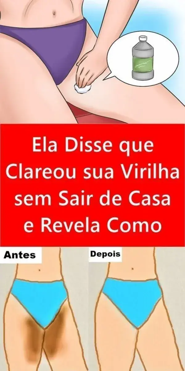 Clareamento da virilha: dicas para manter a pele hidratada durante o processo