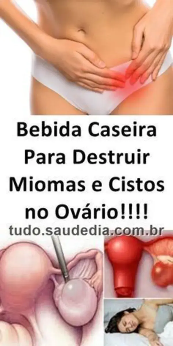 (MINHA NOSSA 😱)Para destruir mioma e cistos no ovário, basta tomar essa bebida!