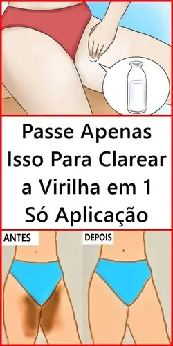 Como prevenir o escurecimento da virilha e manter a pele clara