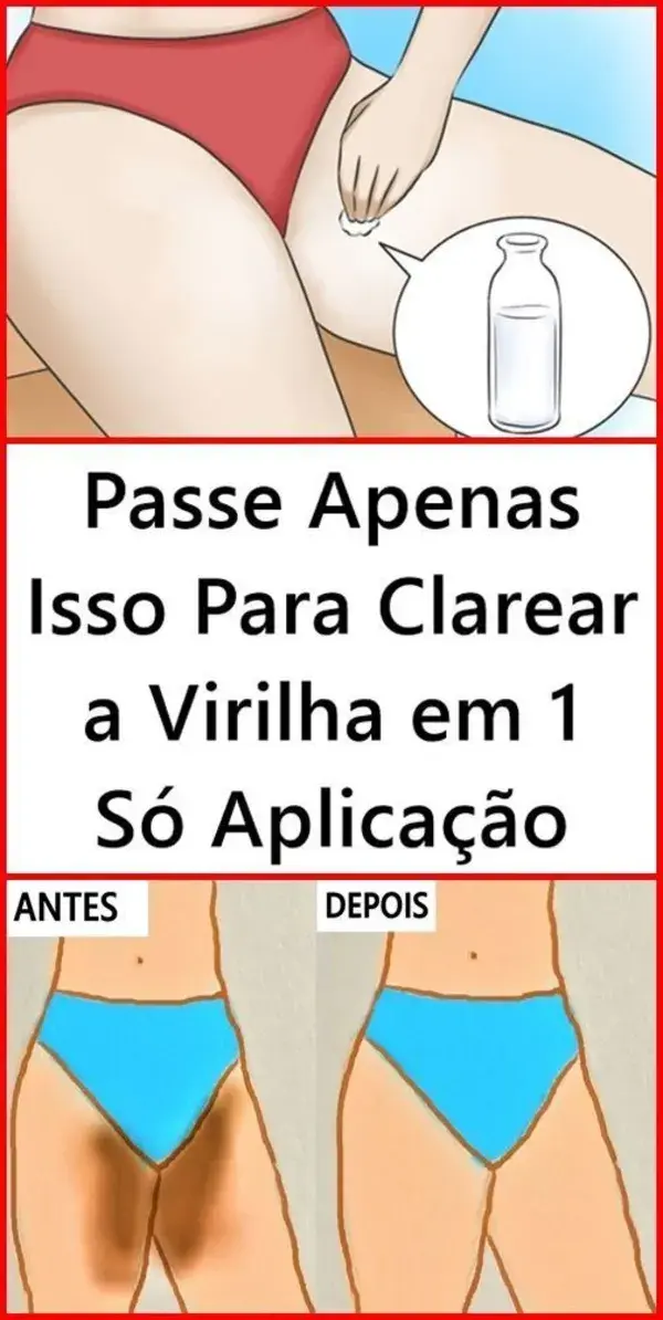 Como prevenir o escurecimento da virilha e manter a pele clara