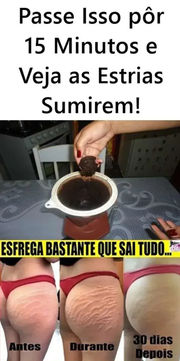 Passe Isso pôr 15 Minutos e Veja as ESTRIAS Sumirem!