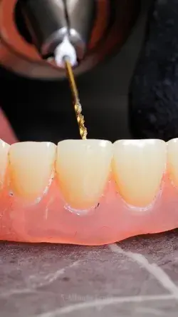 Stylish grills for her beautiful teeth