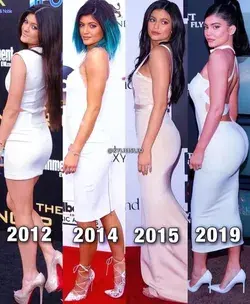 Kylie Jenner transformation