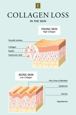 Collagen Loss In The Skin