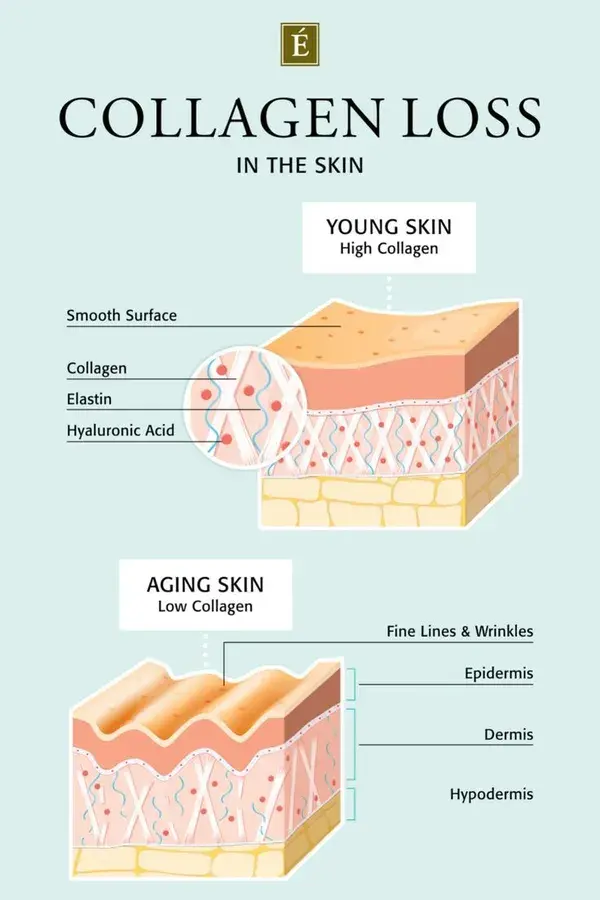 Collagen Loss In The Skin