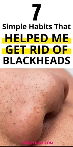 How to Remove Blackheads in 5 Minutes - Blackheads Removal Remedies