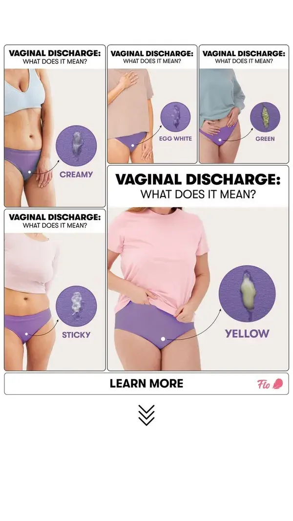 Vaginal Discharge: What Does It Mean?