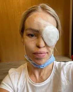 Katie Piper thanks fans for support after emergency transplant: ‘I never take it for granted’