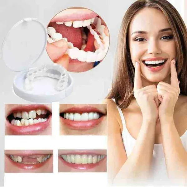 Last Days 58%OFF Snap-On Dentures UPPER TEETH-FEMALE