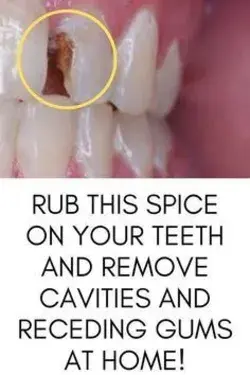 Rub this spice on your teeth and remove Cavities and receding Gums at home!!