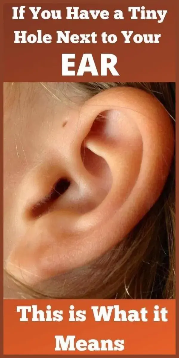 If You Have A Tiny Hole Above Your Ear, Here’s What It Means