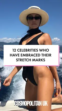 12 celebrities who have embraced their stretch marks