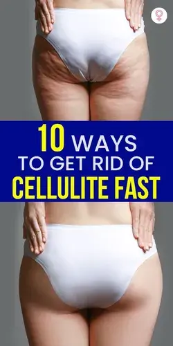 10 Ways To Get Rid Of Cellulite Fast