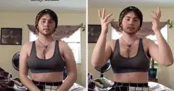 This Trans Man Got Real About Top Surgery, Reminding Us That Hormone Therapy And Reconstructive…
