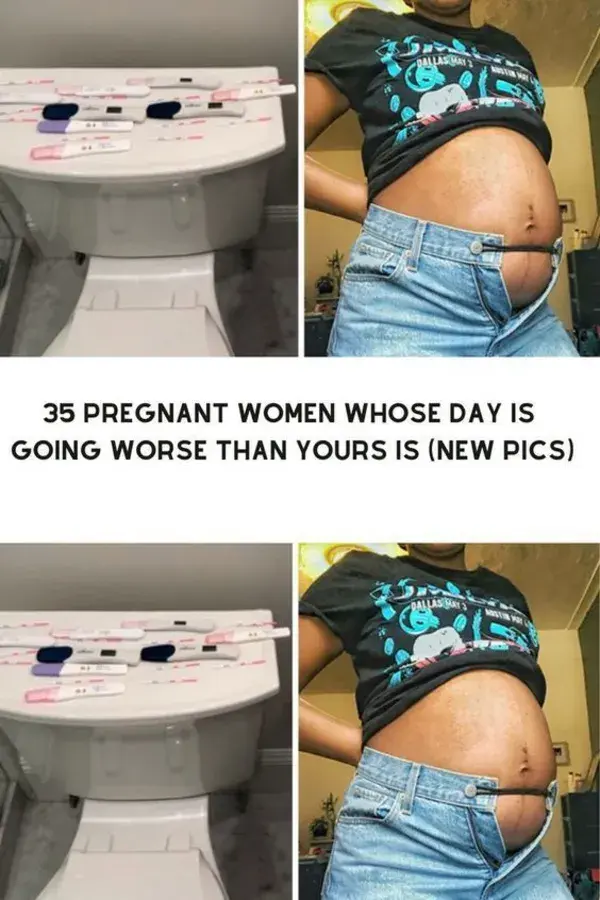 Weird Things That Can Happen To Women During Pregnancy