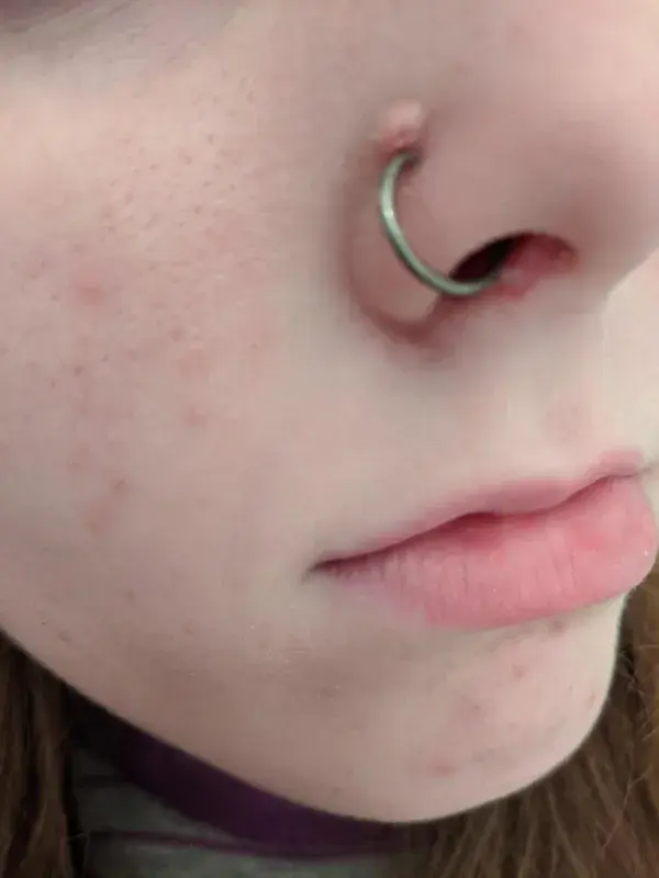 Piercing Nose Bump Reddit