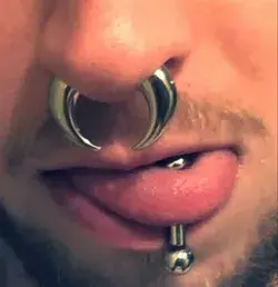Stretched tongue and septum