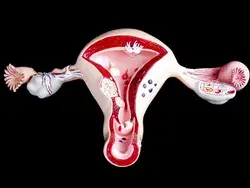 “La regla no duele” El estigma asociado a la endometriosis