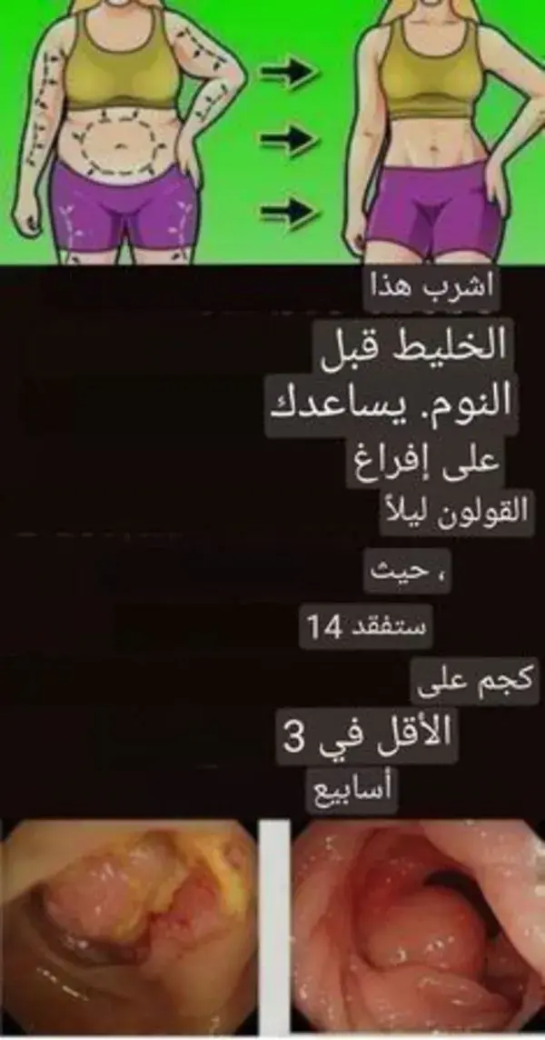 كيف تفقدين 5 كجم في 10 أيام